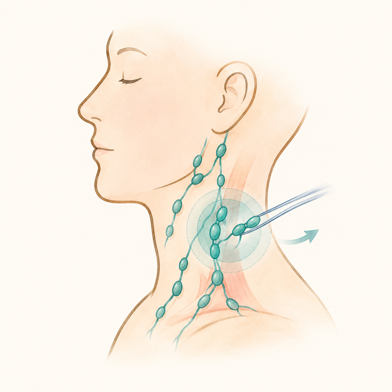 Chirurgie carcinologique ORL curage ganglionnaire du cou 1