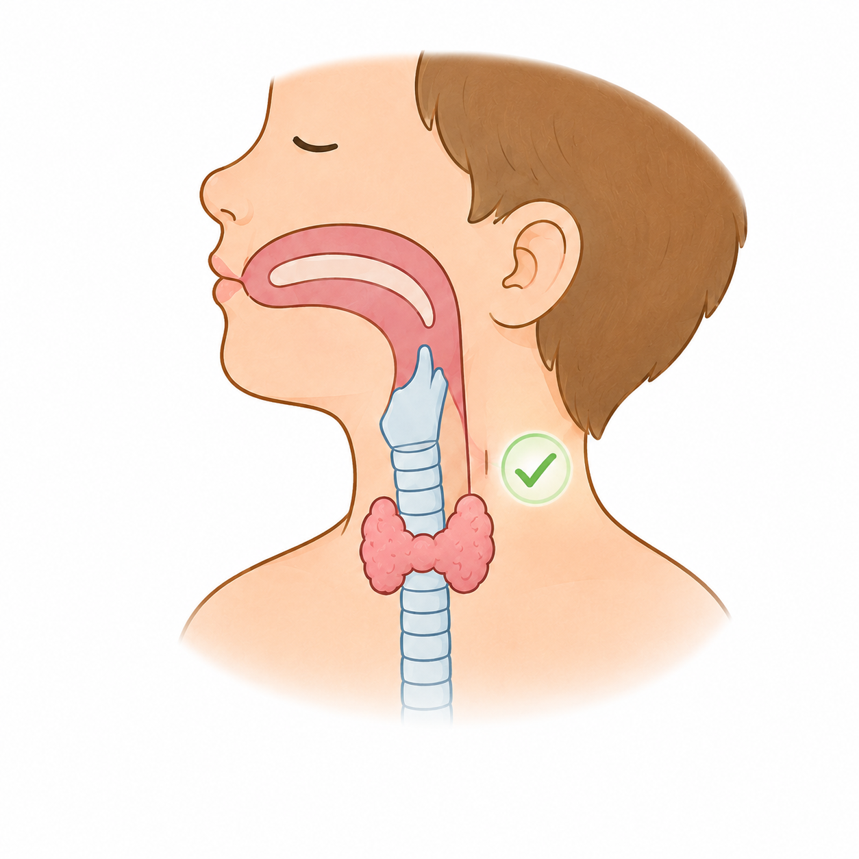 chirurgie Kyste ou fistule de la 4e poche branchiale1