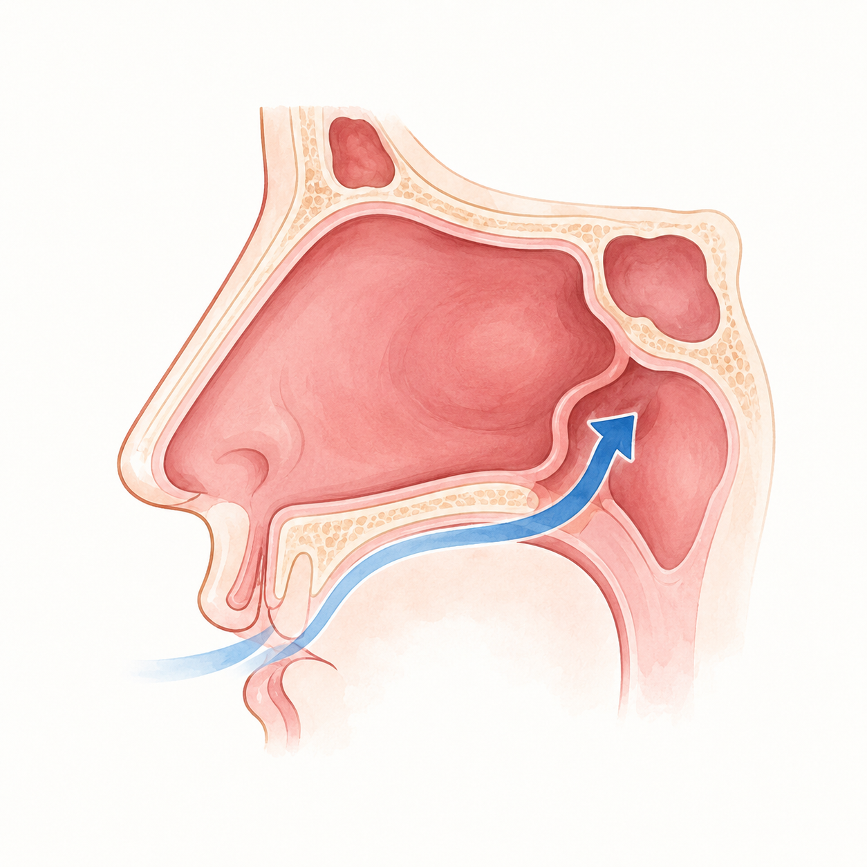 chirurgie Sinusite chronique chirurgie endonasale méatotomie moyenne