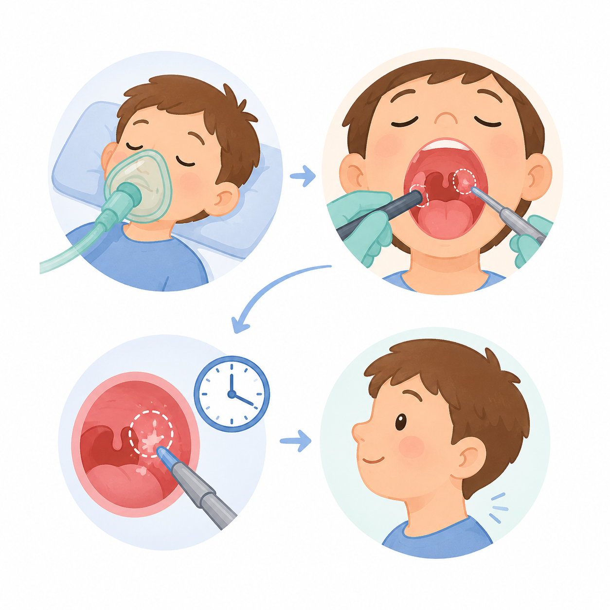 chirurgie pediatrique Adénoïdectomie ou chirurgie des végétations 5