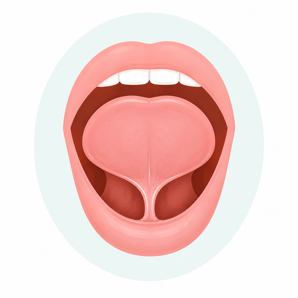 chirurgie pediatrique frénectomie linguale chez l’enfant
